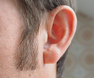 Better quality of life through hearing
